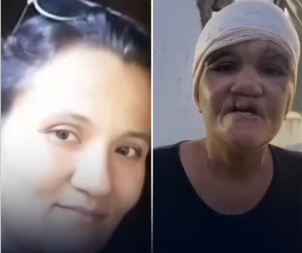 Sobrevivente de tentativa brutal de feminicídio